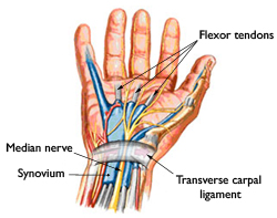 Hand showing Nerve, Ligament, and Tendon affected by Carpal Tunnel Syndrome